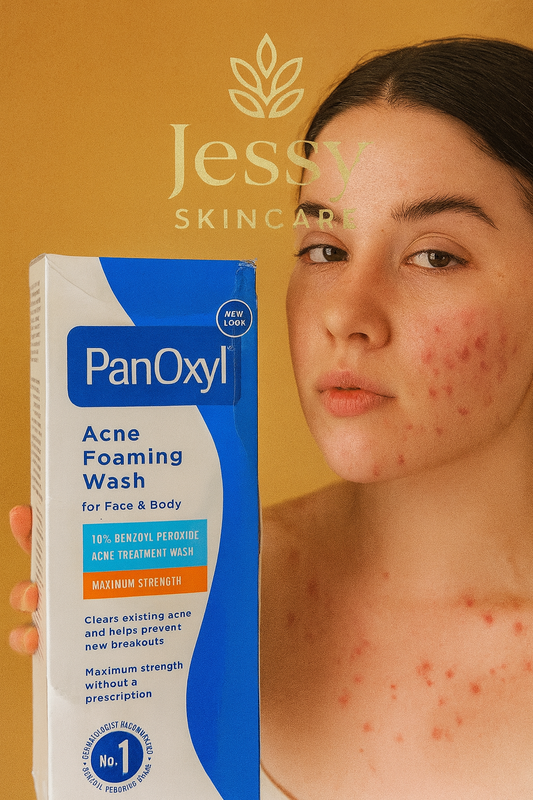 PanOXyl Acne FORM